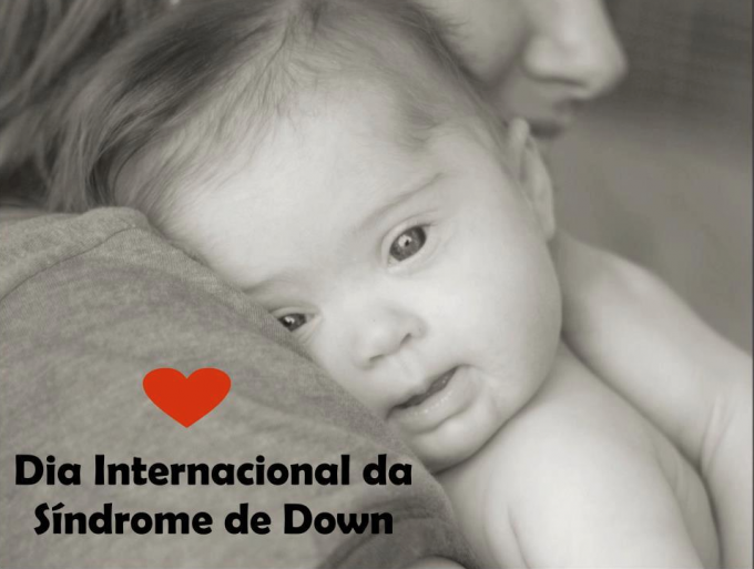 sindrome de down