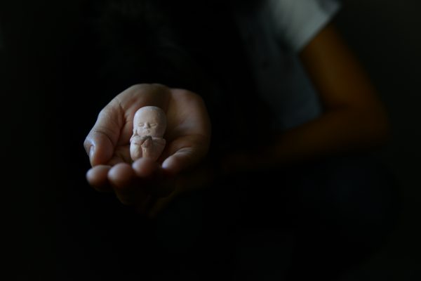 aborto