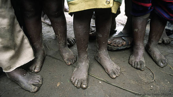 pobres_FotoGettyImages