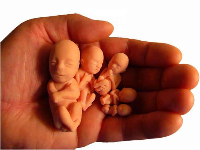 Aborto